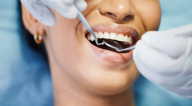 Best Emergency Dental Care for Broken or Chipped Teeth in Port St John, FL